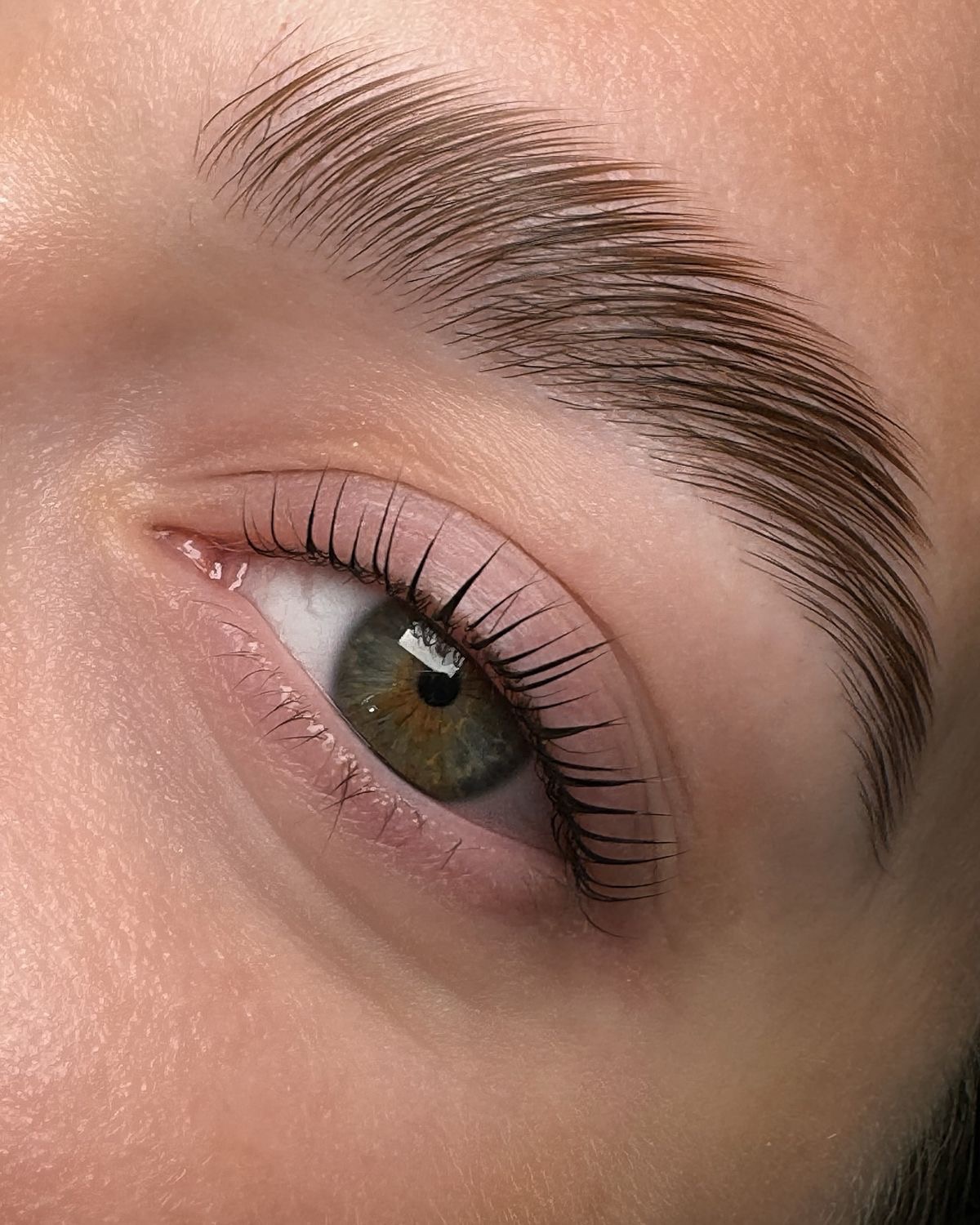 Browlift